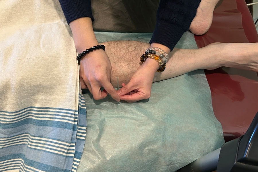 Acupuncture-1.jpeg