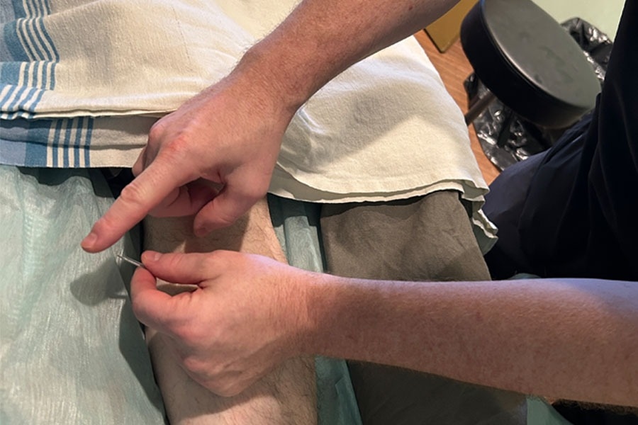 Acupuncture-3.jpeg